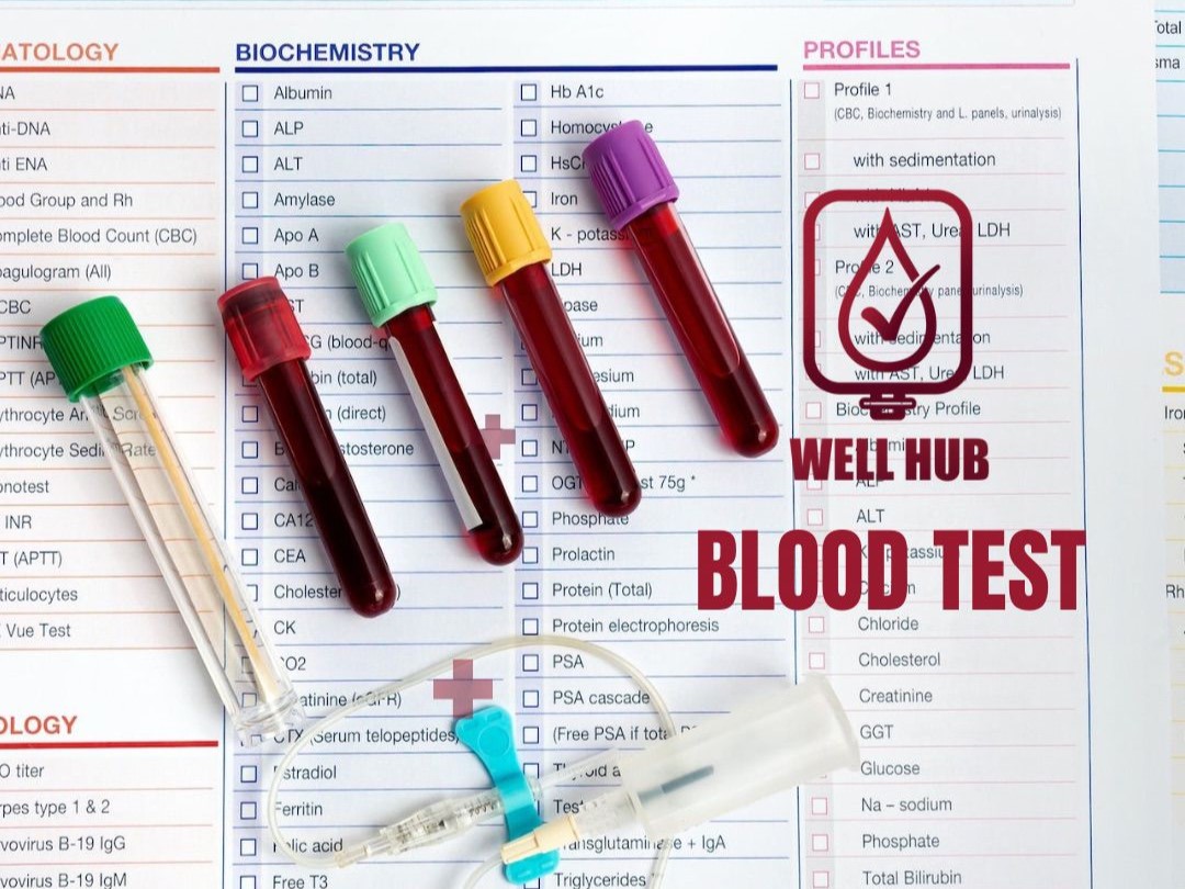 Blood Tests